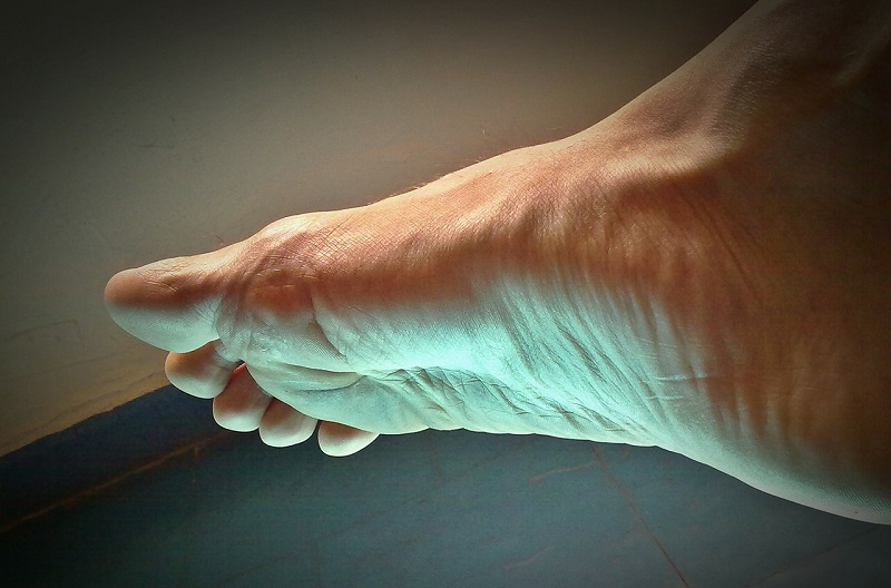 Common Types of Foot Pain and How To Deal With Them